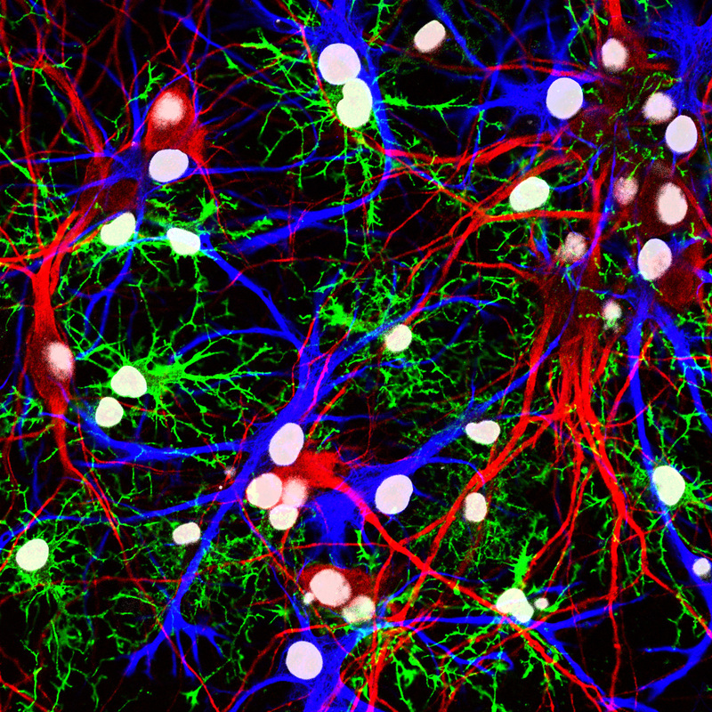 This image shows neurons and different types of glia from the hippocampus of a rat. This image shows neurons and different types of glia from the hippocampus of a rat.