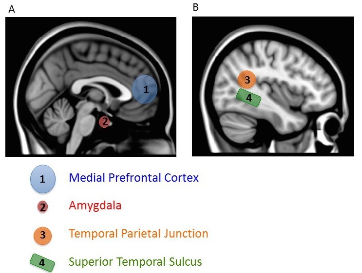 Two sagittal images of the brain. Two sagittal images of the brain.
