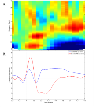 Example of EEG analysis output. Example of EEG analysis output.