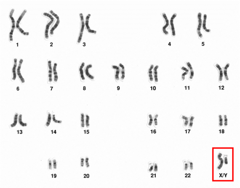 Microscopic image of human male chromosomes, sex chromosomes highlighted. Microscopic image of human male chromosomes, sex chromosomes highlighted.